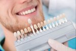post whitening care for bright teeth