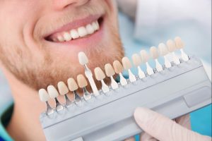 post whitening care for bright teeth