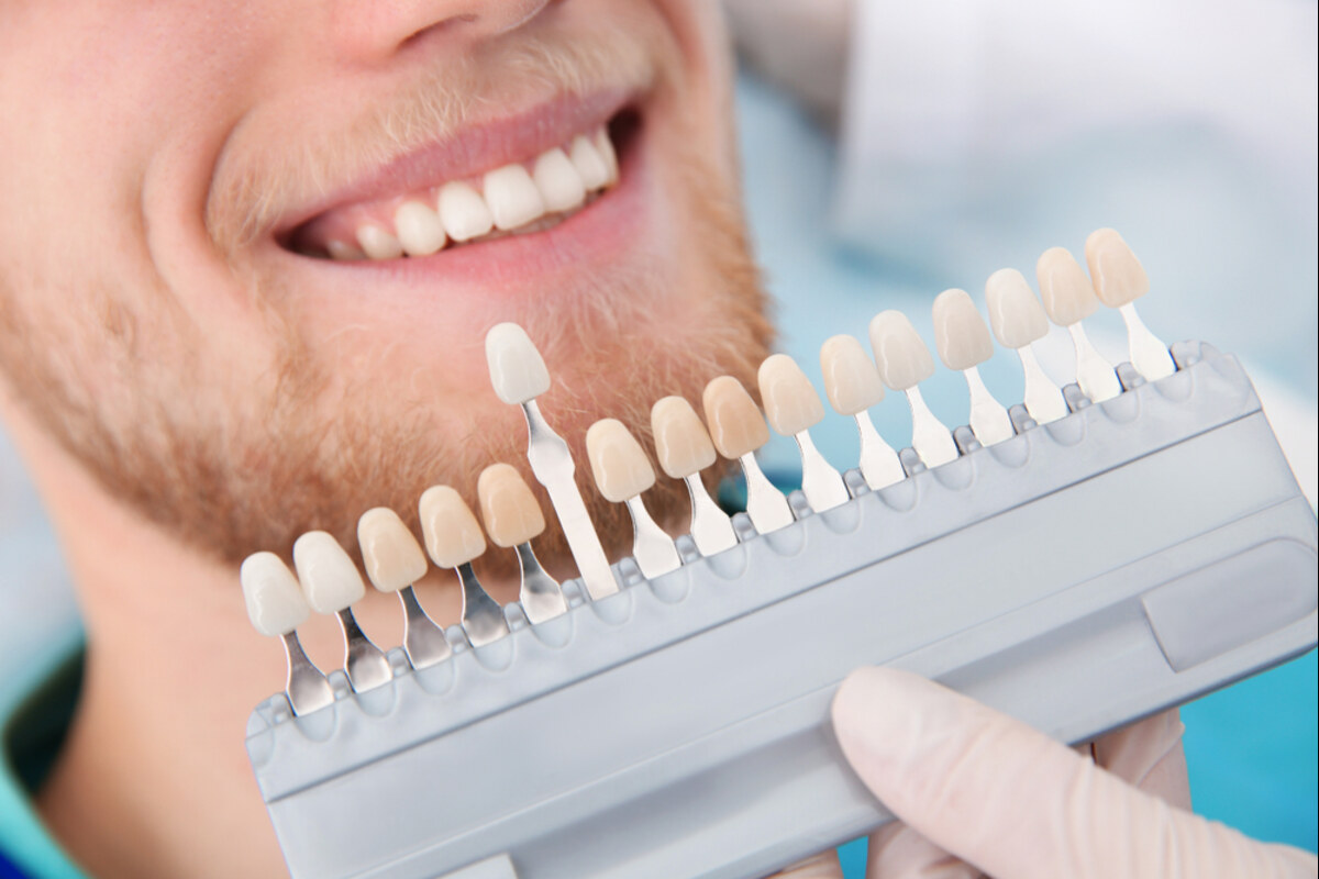 post whitening care for bright teeth