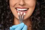 do porcelain veneers damage natural teeth