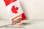 how-does-the-canadian-dental-care-plan-help-cover-dentures-and-implants