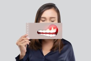 what are the signs that i need periodontal treatment