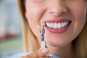 dental veneers in airdrie, ab